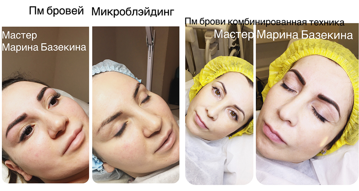 микроблейдинг