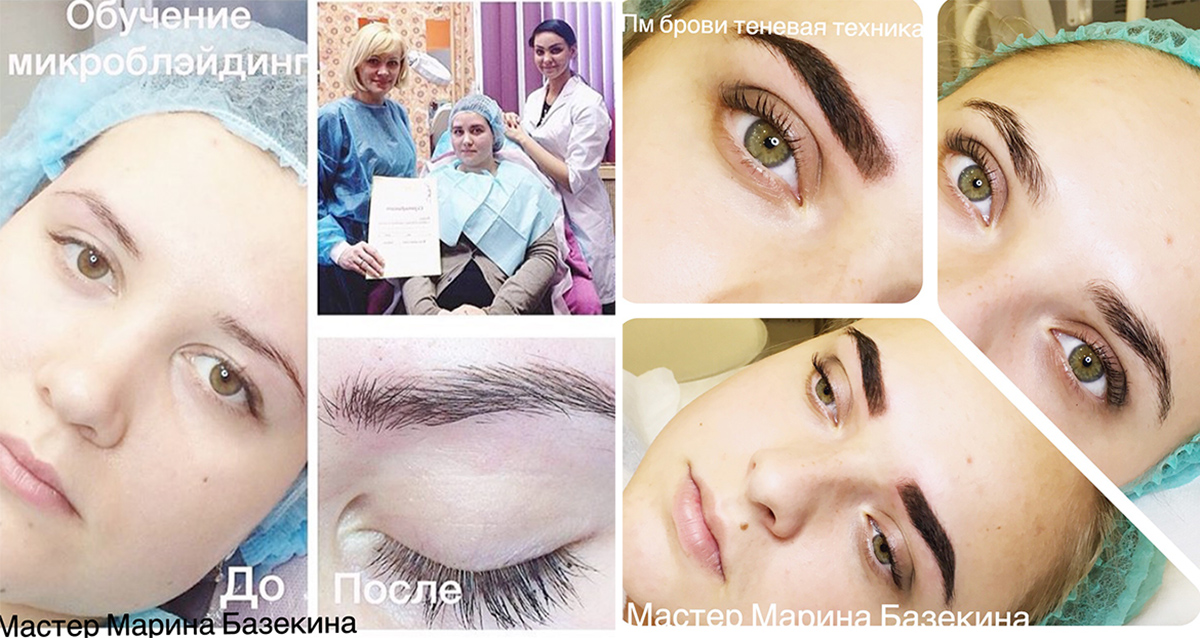 микроблейдинг
